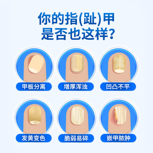 康速达灰指甲官方旗舰店正品冷敷凝胶医用退热凝胶甲沟炎趾甲 商品图2