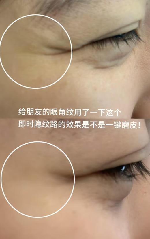 【清仓好价】Murad慕拉得青春焕颜精准抚纹精华保湿修护淡纹15ml（效期至26.1） 商品图1
