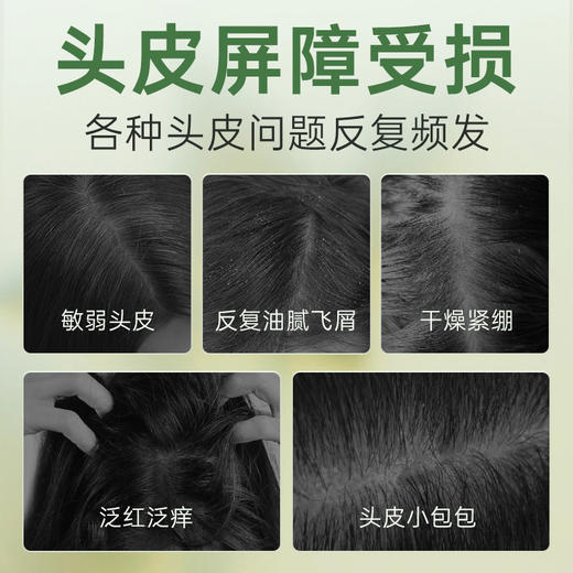 百年扁氏艾草去屑止痒头皮素 商品图1