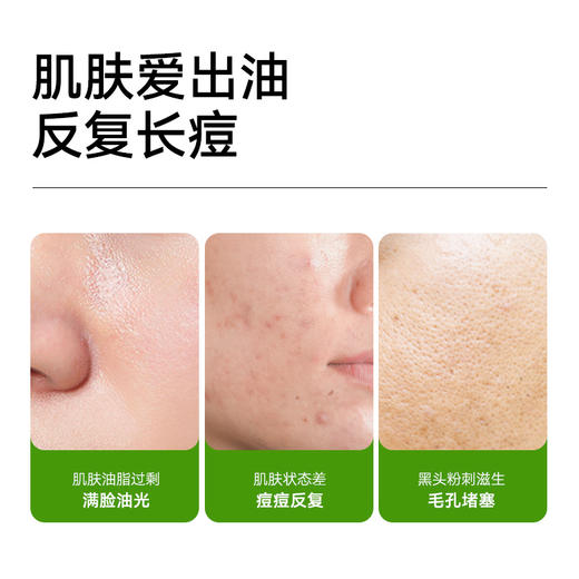 满婷皂系列100g*3+起泡网——换皂的话联系客服订单备注——加入会员下单享8折，满69元送满婷清满保湿洁面乳，满119元送祛痘控油沐浴乳 商品图4