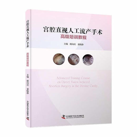 宫腔直视人工流产手术高级培训教程 商品图0