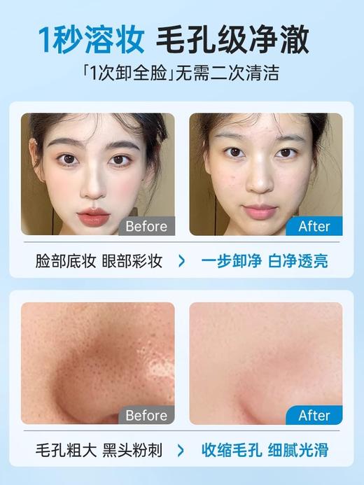 【秒卸浓妆 0残留】透真酵素净澈卸妆水300ml#眼唇脸部三合一油膏乳液深层清洁毛孔官方品牌正品旗舰店 商品图1