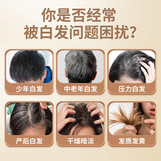 安泰宁医用退热凝胶白发根转黑发改善黄干燥暗淡养发正品 商品图1