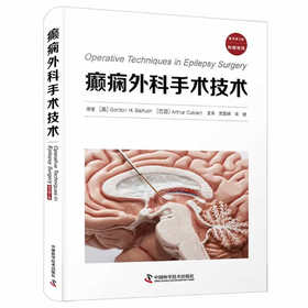 癫痫外科手术技术（原书第2版）