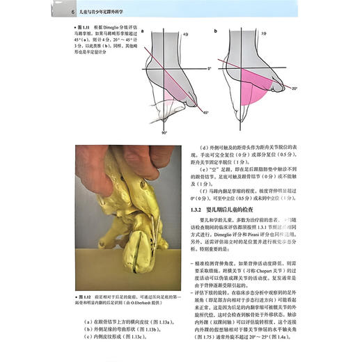 儿童与青少年足踝外科学 马昕 王旭译 通过大量的足底压力动态观察图强调了足踝功能方面的内容 9787565928826北京大学医学出版社 商品图4