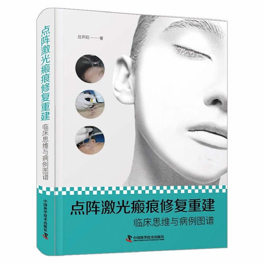 点阵激光瘢痕修复重建：临床思维与病例图谱 商品图0