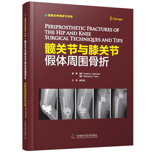 髋关节与膝关节假体周围骨折 商品图0