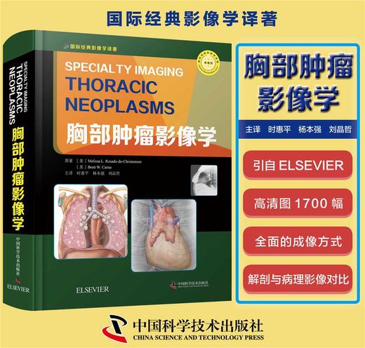 胸部肿瘤影像学 商品图0