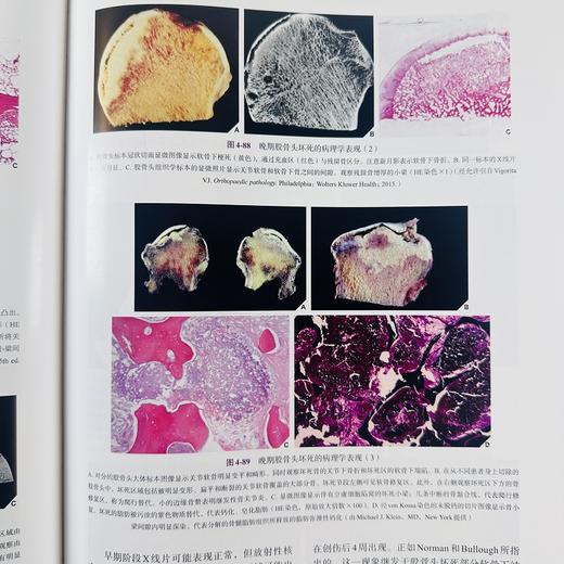 实用骨科影像学（中文翻译版，第7版） 商品图11