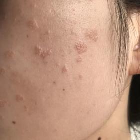  这3处长疙瘩，多是宫颈癌的信号！不能小觑~ 