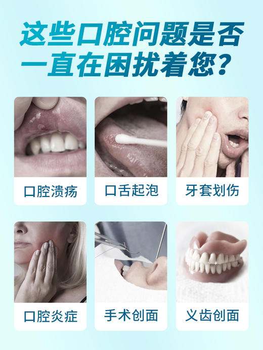 益口宁口腔溃疡凝胶缓解口舌上火烂嘴肿痛护理 商品图1