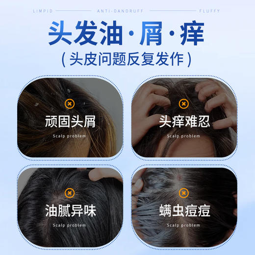 【金币兑换】康迪生二硫化硒洗发水清爽去屑改善头痒清洁去油轻盈蓬松官方正品 商品图1