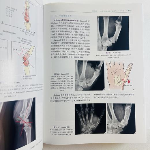 实用骨科影像学（中文翻译版，第7版） 商品图8