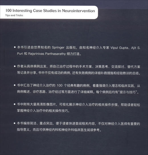 100个有趣的神经介入病例：提示与技巧 商品图2