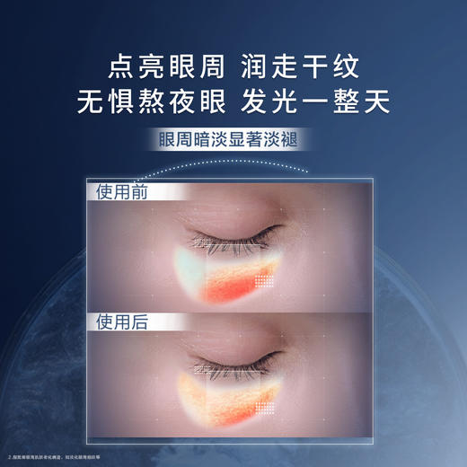 LAN3614273274647 兰蔻LANCOME 小黑瓶发光眼霜 秋冬保湿滋润焕亮眼周淡纹熬夜眼霜 商品图1