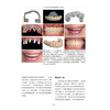 水平与垂直骨增量在种植治疗中的应用 克雷格·米施 骨科学种植体植入钛网骨移植口腔牙体牙髓 辽宁科学技术出版社9787559140302 商品缩略图4