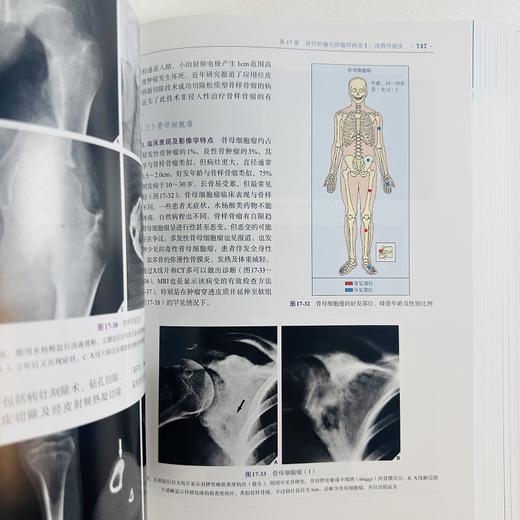 实用骨科影像学（中文翻译版，第7版） 商品图12