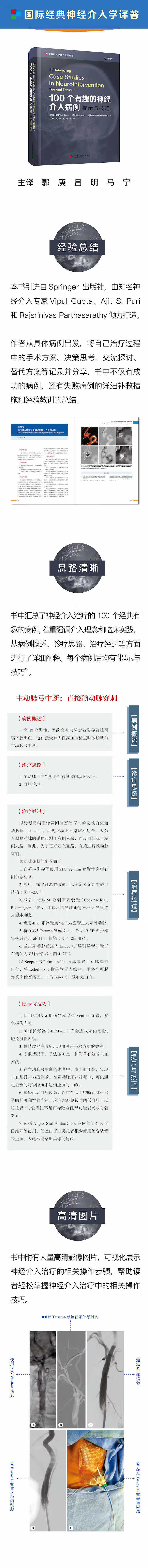 100个有趣的神经介入--卖点介绍.jpg