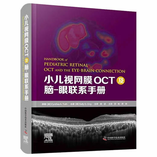 小儿视网膜OCT及脑-眼联系手册 商品图1