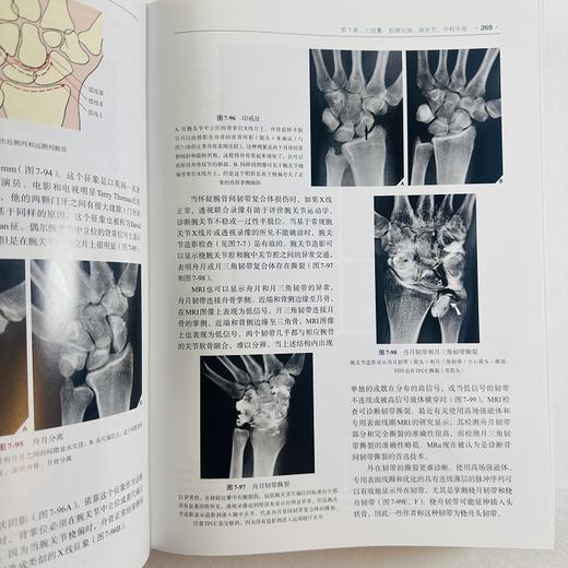 实用骨科影像学（中文翻译版，第7版） 商品图9