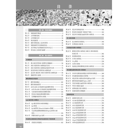 肾脏病理诊断学 第4四版 余英豪 滕晓东 主译 全面介绍了超过265种肾脏疾病的关键病理和临床特征 9787117374088 人民卫生出版社 商品图3