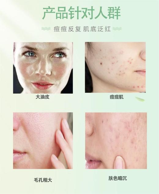 八九点钟的太阳净颜祛痘精华液30ml 商品图1