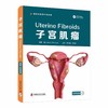 子宫肌瘤 商品缩略图0
