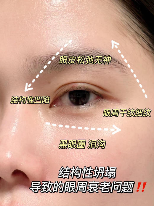 雅诗兰黛UK美版浓缩高能小棕瓶眼部精华液泪沟填平 商品图2