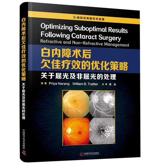 白内障术后欠佳疗效的优化策略：关于屈光及非屈光的处理 商品图0