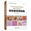 皮肤癌实用指南 商品缩略图0