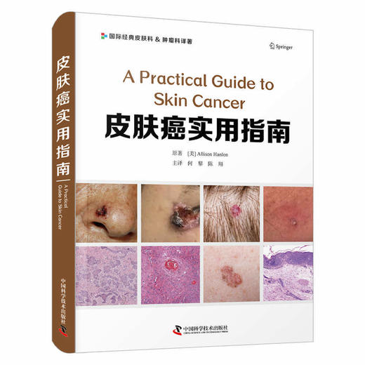 皮肤癌实用指南 商品图0