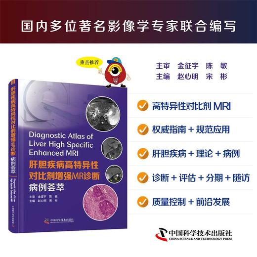 肝胆疾病高特异性对比剂增强MR诊断:病例荟萃 商品图0