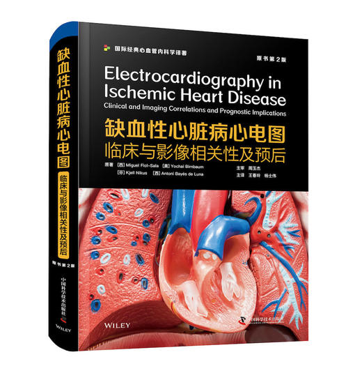 缺血性心脏病心电图：临床与影像相关性及预后（原书第2版） 商品图1