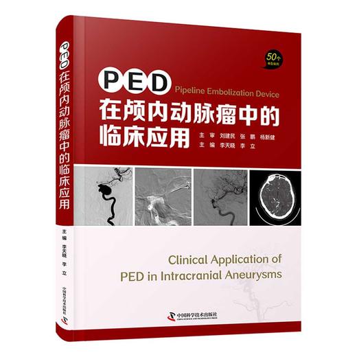 PED在颅内动脉瘤中的临床应用 商品图0