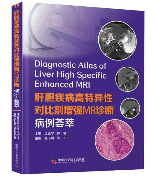 肝胆疾病高特异性对比剂增强MR诊断:病例荟萃 商品图1