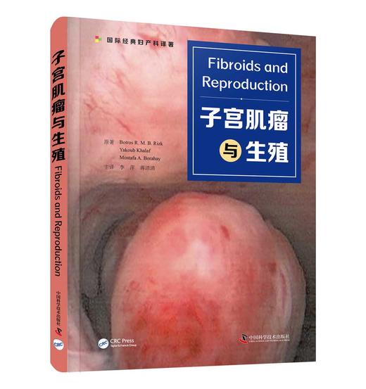 子宫肌瘤与生殖 商品图1