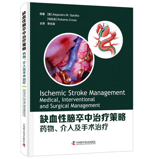 缺血性脑卒中治疗策略：yao物、介入及手术治疗 商品图1
