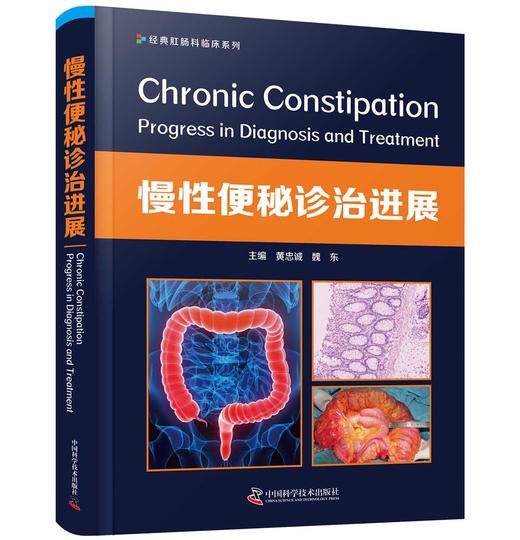 慢性便秘诊治进展 商品图1