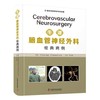 牛津脑血管神经外科经典病例 商品缩略图0