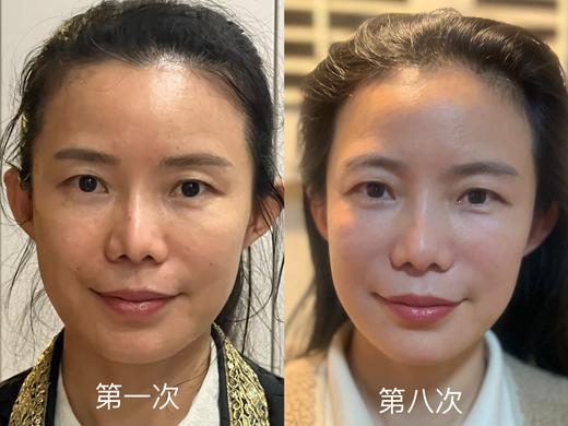 中女胶原蛋白抗衰自由| |美业新物种鹿巴胶原仪套盒 商品图5