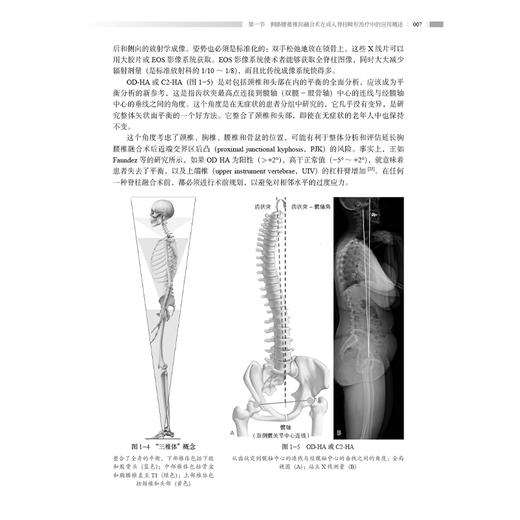 侧路腰椎椎间融合术治疗成人脊柱畸形：基础与临床 陈其昕 李方财 主编 本书适合脊柱外科医师 从事相关研究的科研人员等参考 商品图4