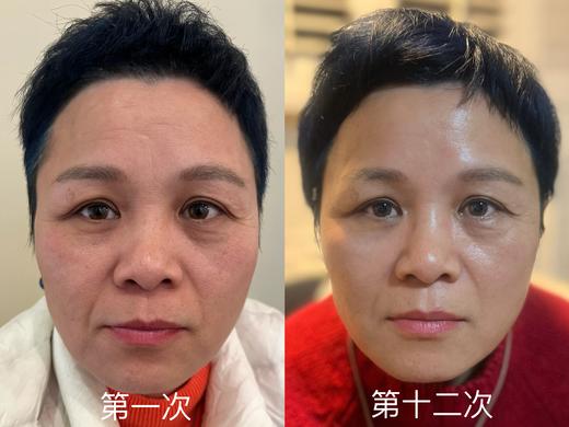 中女胶原蛋白抗衰自由| |美业新物种鹿巴胶原仪套盒 商品图6