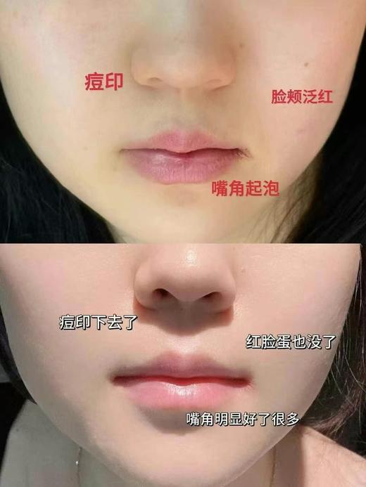 杰西-液态光子疗伤绒毛花面膜(5片/盒、100盒/箱) 商品图2