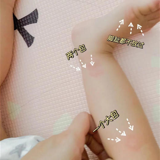 【泰国L兰纳蚊子膏20ml】滚珠涂抹，快速消红止痒 超好用的止痒、消包、提神好帮手 1支多用!不仅可以驱蚊消肿止痒 晕车 晕船 头晕 中暑舎与鼻塞(都可以有效缓解 商品图4