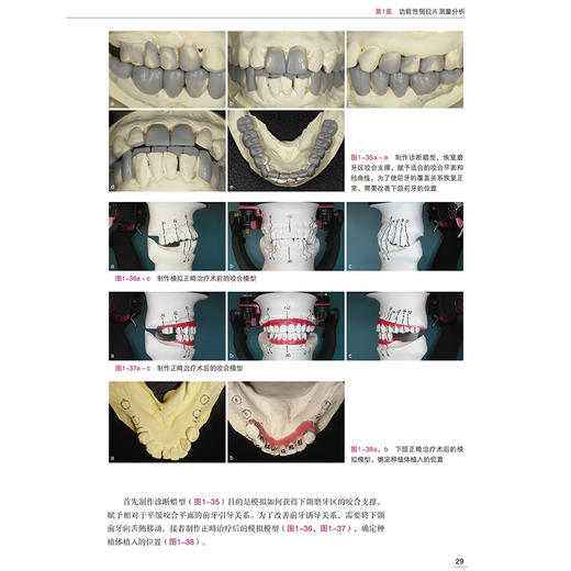 口腔综合修复策略 咬合功能重建 土屋贤司著 种植修复口腔咬合治疗修复治疗策略种植体咬合变化 辽宁科学技术出版社 商品图3