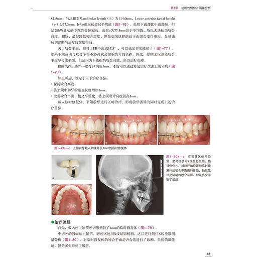 口腔综合修复策略 咬合功能重建 土屋贤司著 种植修复口腔咬合治疗修复治疗策略种植体咬合变化 辽宁科学技术出版社 商品图4