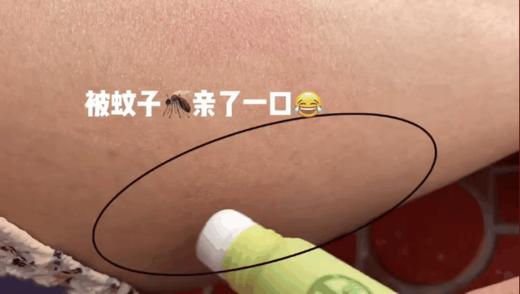 【泰国L兰纳蚊子膏20ml】滚珠涂抹，快速消红止痒 超好用的止痒、消包、提神好帮手 1支多用!不仅可以驱蚊消肿止痒 晕车 晕船 头晕 中暑舎与鼻塞(都可以有效缓解 商品图1