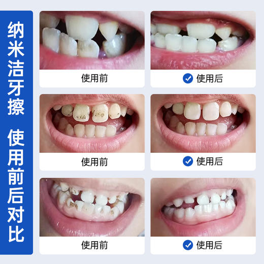 GRAREY格瑞亚纳米洁牙擦 A-4417 商品图4