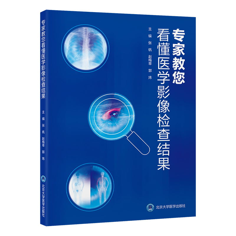 专家教您看懂医学影像检查结果   张帆 赵梅莘 郭炜 主编   北医社