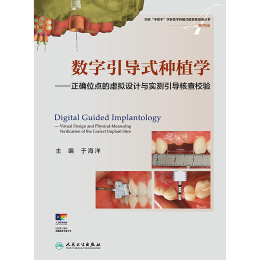 数字引导式种植学——正确位点的虚拟设计与实测引导核查校验 商品图1